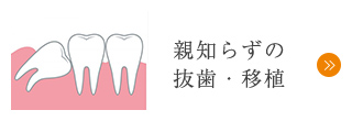 親知らずの抜歯・移植