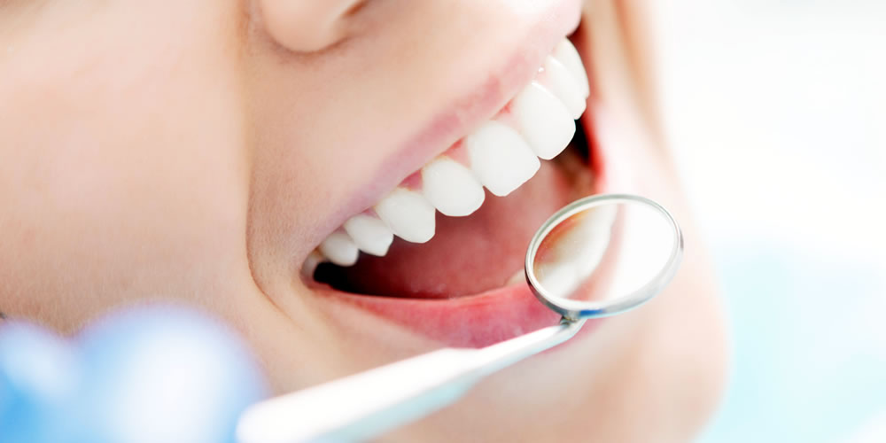 歯周病 定期検診（メインテナンス）の重要性