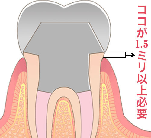 サンプルイメージ